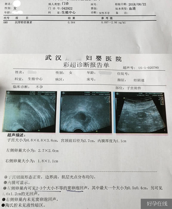 amh检查报告