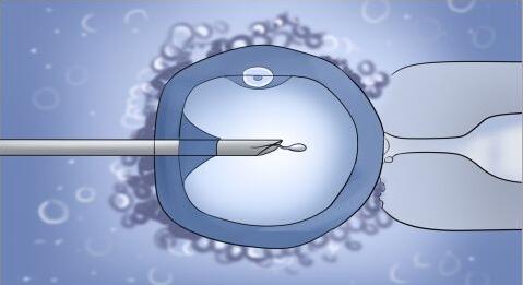 泰国试管婴儿移植冷冻胚胎好吗，试管婴儿怎么治疗输卵管阻塞不孕