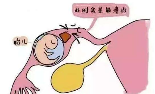 输卵管阻塞是做手术还是去泰国做试管婴儿